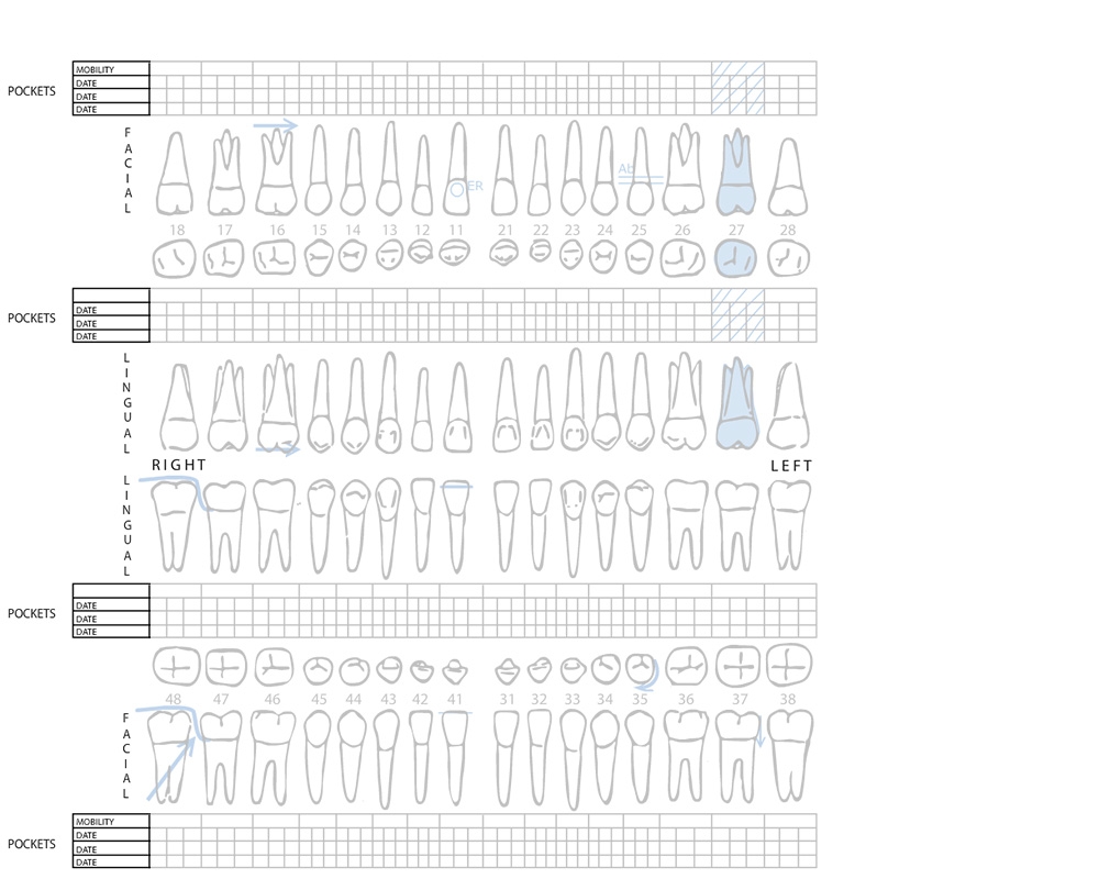 Dental Charting Activity ECampusOntario H5P Studio